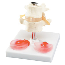 product image Budget Lumbar Vertebrae with Interchangeable Discs
