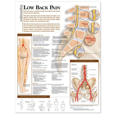 product image Understanding Low Back Discomfort Anatomical Chart