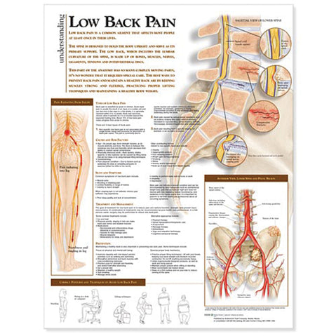 Understanding Low Back Discomfort Anatomical Chart