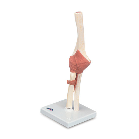 Functional Elbow Joint Model