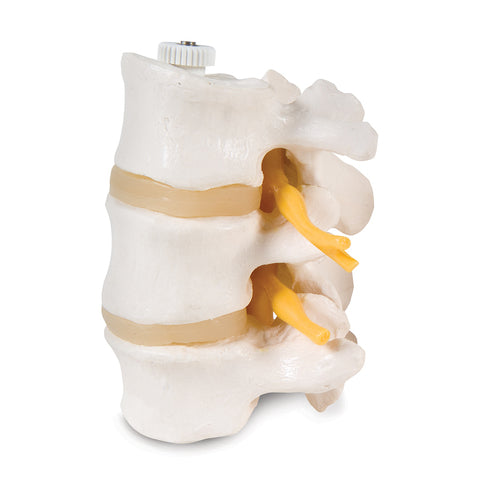 3 Lumbar Vertebrae (Mounted)