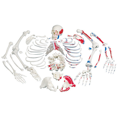 Disarticulated Full Human Skeleton with 3 Piece Skull