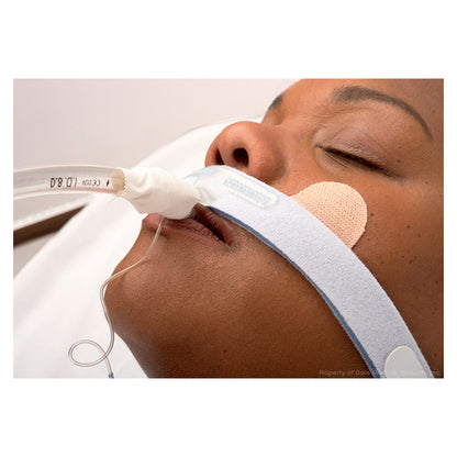 Stabilock Endotracheal Tube Holder